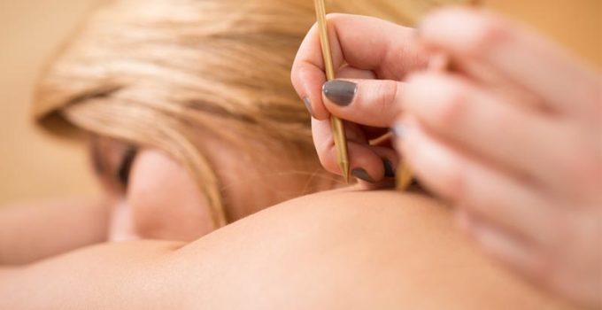Cómo preparar tu cuerpo antes de una sesión de acupuntura