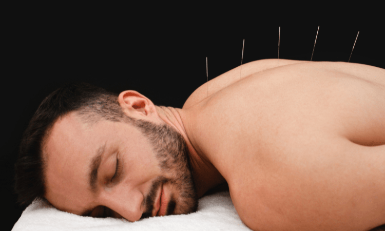 Acupuntura para aliviar el estrés y la ansiedad
